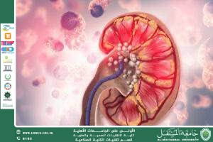 Scientific Article by Ms. Tabarak Ahmed Turki Al-Azzawi Title: Stem Cell Therapy for Kidney Failure: An Advanced Technique That Transforms Patients’ Lives