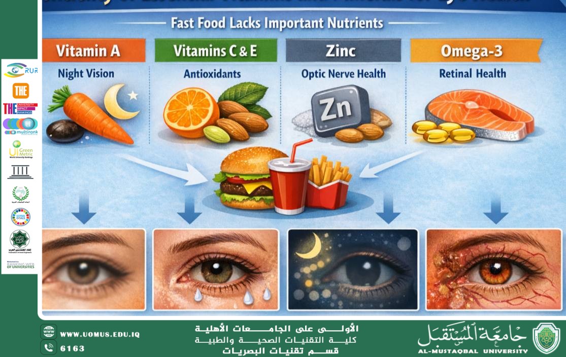 مقاله علمية للست تمارا نهاد عباس بعنوان تأثير الأطعمة السريعة على صحة العين