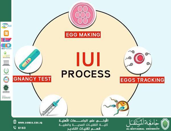 A scientific article on intrauterine insemination (IUI)