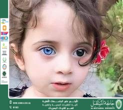 مقالة علمية لرئيس قسم تقنيات البصريات ا.م.د منذر سمين شكر بعنوان: الهيتروكروميا