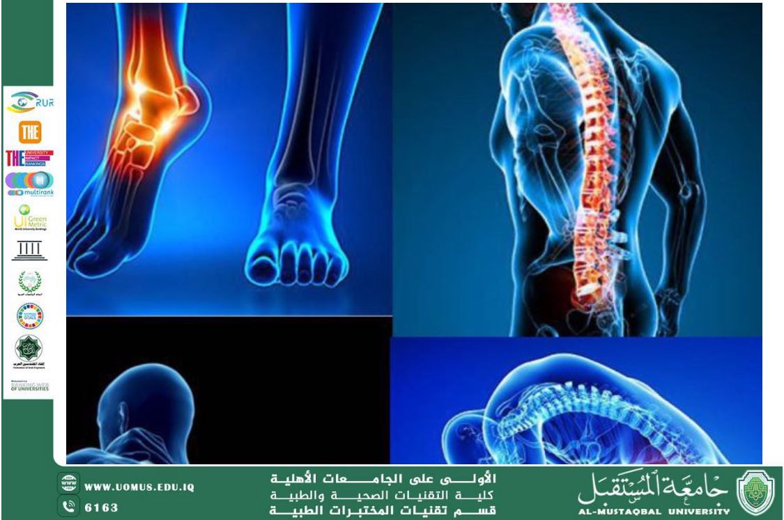 مقالة علمية للسيدة زهراء بدر محمد بعنوان : الفيبريوميالجيا: فهم أعمق لاضطراب الألم المزمن