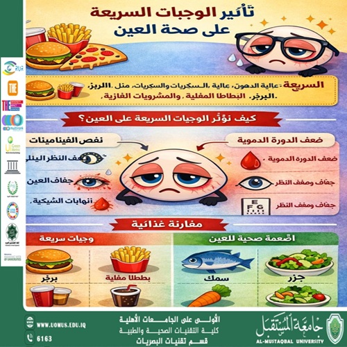 نشاط توعوي حول تأثير الوجبات السريعة على صحة العين