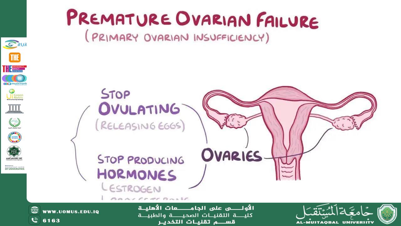 Premature Ovarian Insufficiency (POI): Understanding Early Ovarian Failure
