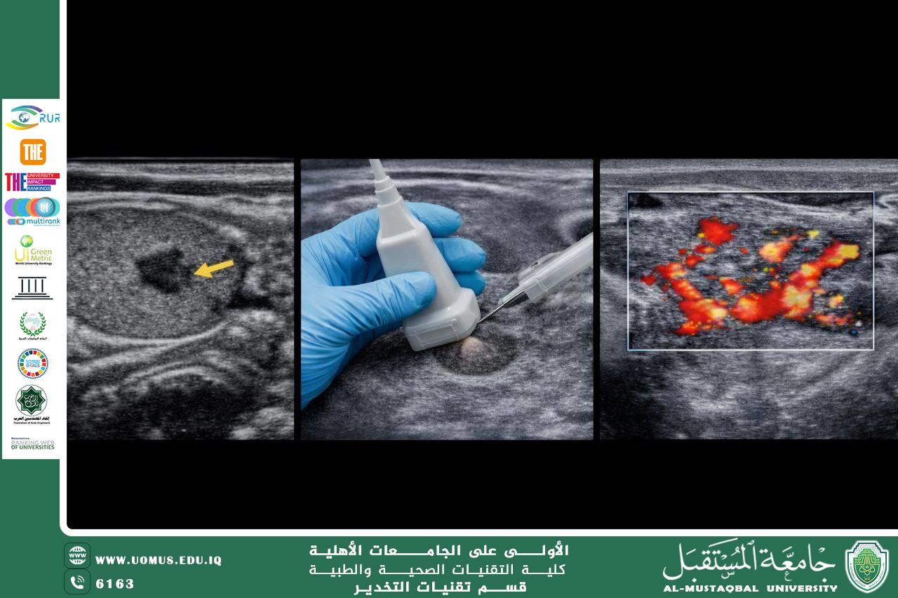 Detection of Thyroid Gland Diseases