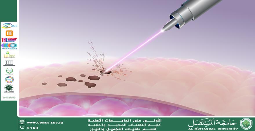 مقالة علميه لمقرر القسم م.د محمد عبد الله جاسم بعنوان تشتّت الليزر في الأنسجة: الآليات والتأثيرات