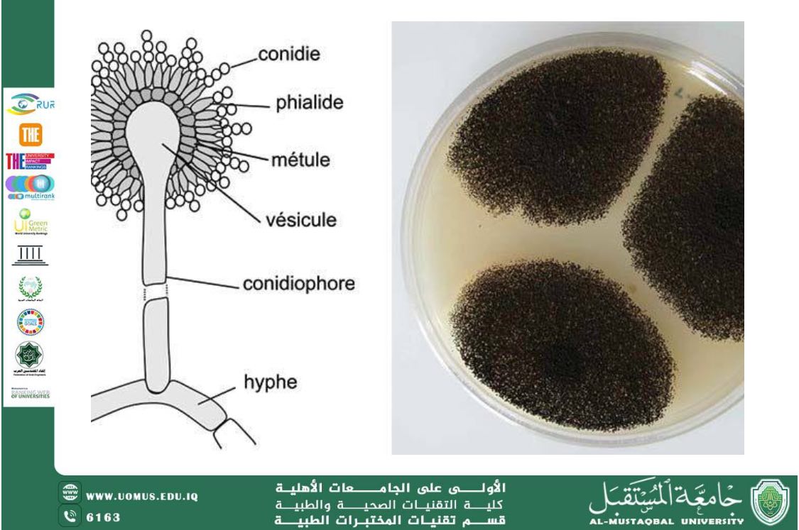 Scientific Article by Ms. Zainab Mahmoud titled: Aspergillus niger (Black Aspergillosis)