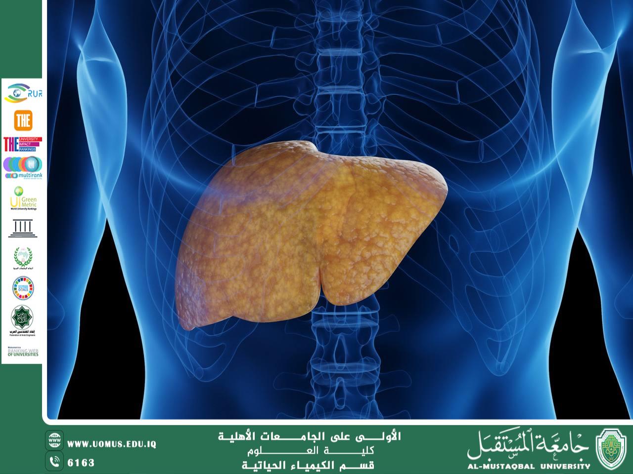مقالة علمية للتدريسي د. داليا شاكر عبيدة  بعنوان   الكبد الدهني الكحولي (Alcoholic Fatty Liver Disease)