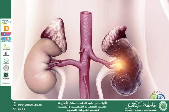 Renal Failure