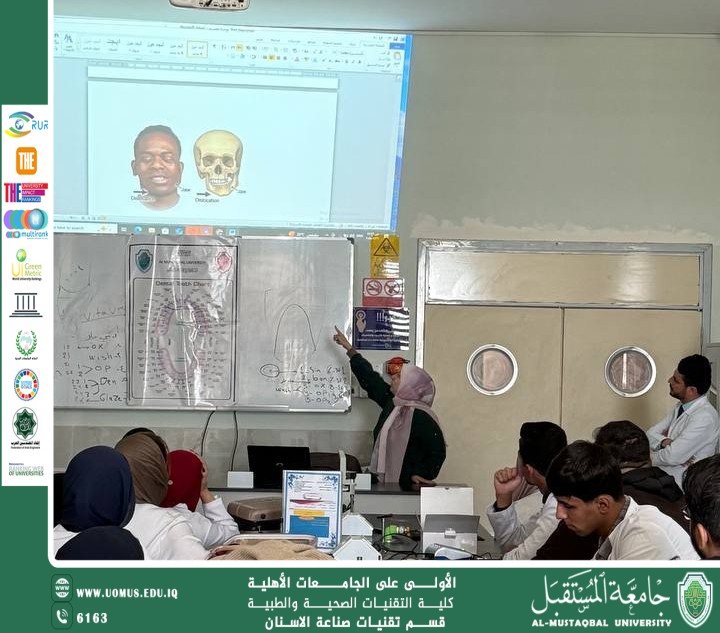 TMJ dislocation  ورشة علمية بعنوان