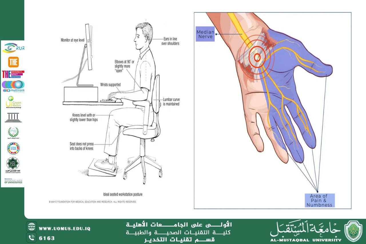Carpal Tunnel Syndrome as the focus of a scientific workshop organized by the Department of Anesthesia Techniques