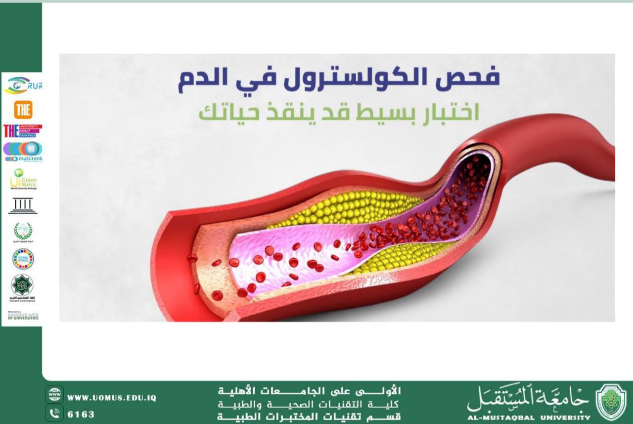 مقالة علمية للدكتور حبيب صاحب نهر بعنوان الكوليسترول