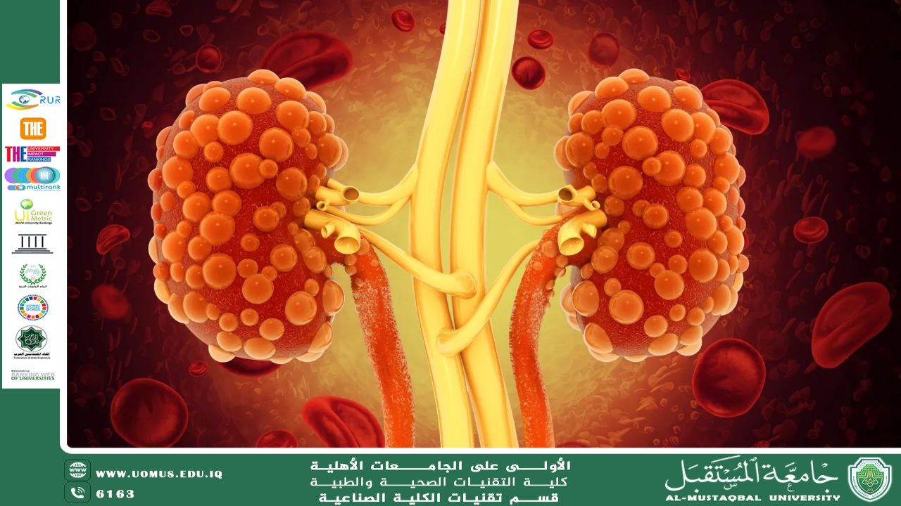 . Polycystic kidney disease (PKD) A scientific article prepared by Dr Tuoqa Hazim Abd Allah