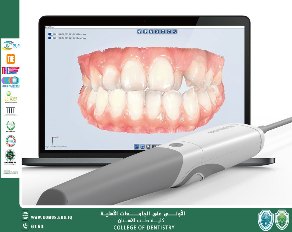 مقارنة بين الطبعات التقليدية والرقمية في طب الأسنان