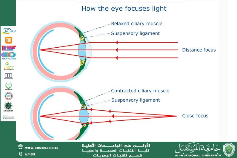 مقالة علمية للست حنين حيدر حسين بعنوان"التكامل بين القرنية والعدسة"