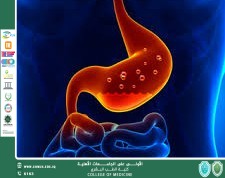 تهيج القولون (القولون العصبي