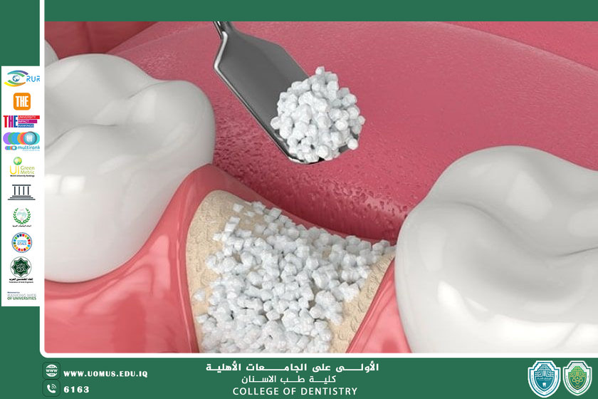 Bioactive Materials في طب الأسنان