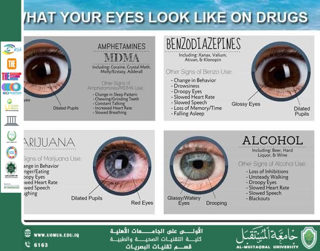 مقالة علمية للتدريسي غيث علي محمود بعنوان "كيف تُحدث المخدرات تغيّرات خطيرة في العين؟ نظرة موجزة على أبرز التأثيرات العينية"
