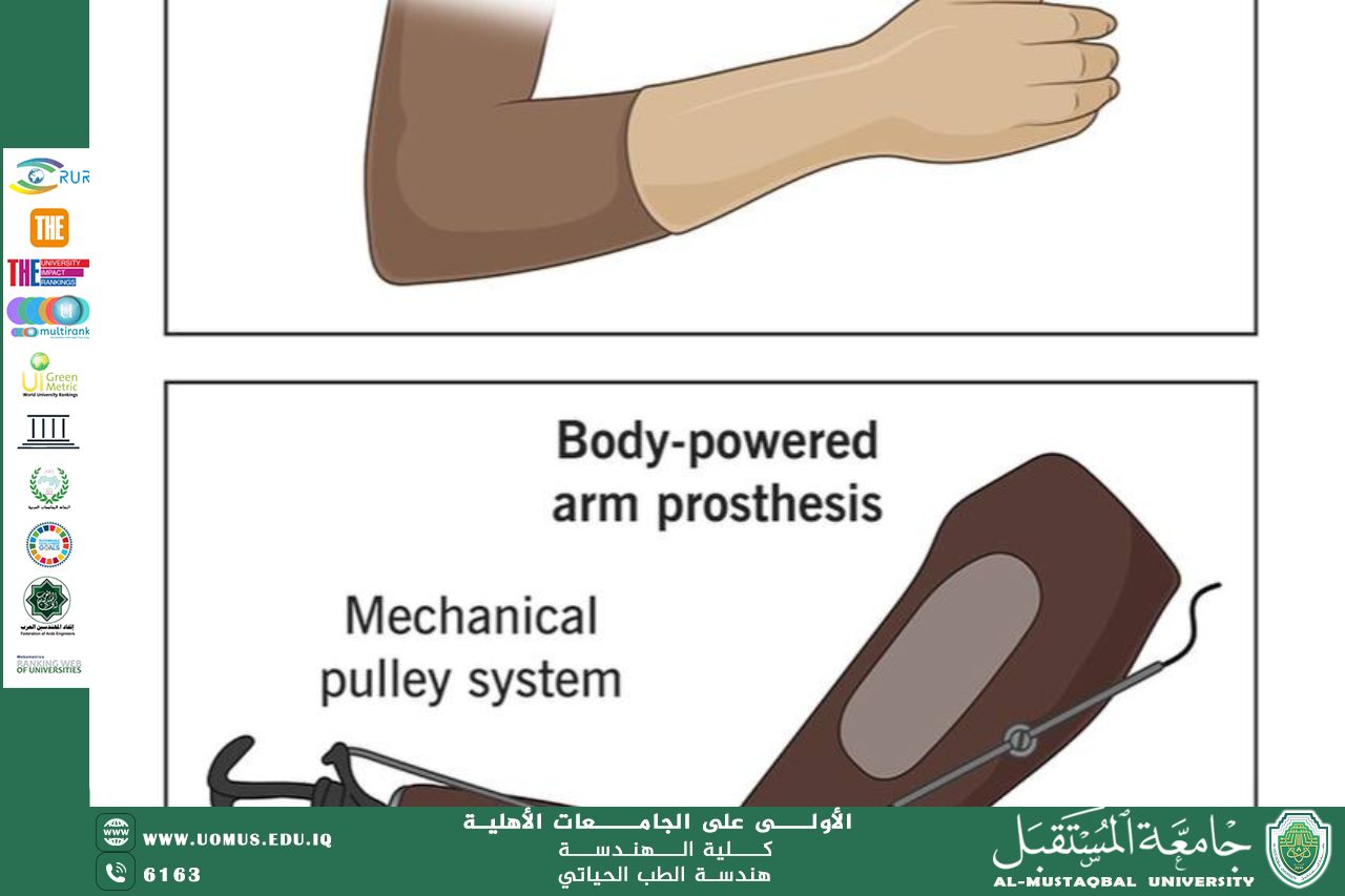 An article titled "What is a prosthetic arm" by engineer Mohammed Abdul Karim Razouki