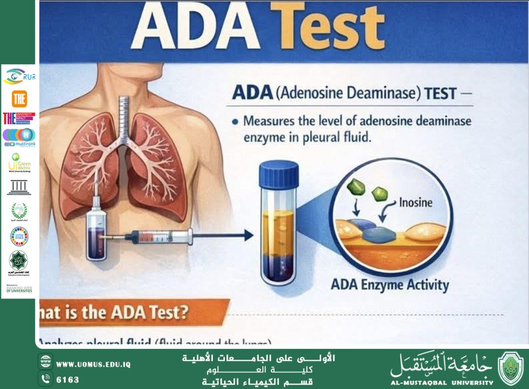 تحليل ADA: الأهمية السريرية في تشخيص الانصباب الجنبي إعداد: م.م. عباس حمزة خضير قسم الكيمياء الحياتية – كلية العلوم – جامعة المستقبل