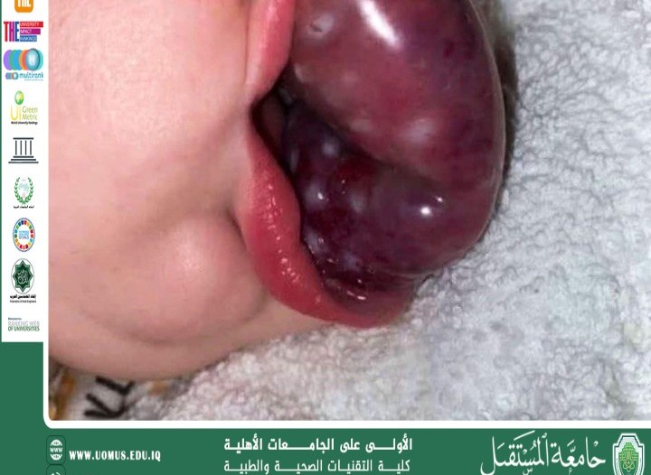 الصدمة الوعائية العصبية (Neurogenic Shock)