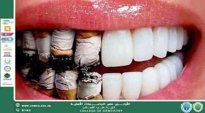 تأثير التدخين على صحة الفم والأسنان