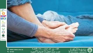 A scientific article by lecturer (M.M. Saja Jawad Obeid) entitled "Rheumatism"