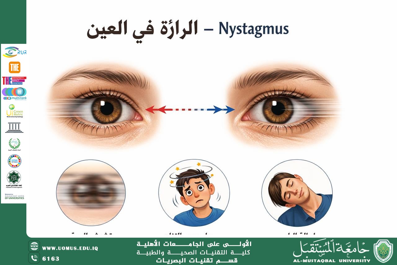 مقالة علميه للست ريهام صفاء نحم بعنوان الرأرأة